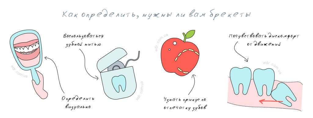 брекеты ставить или нет