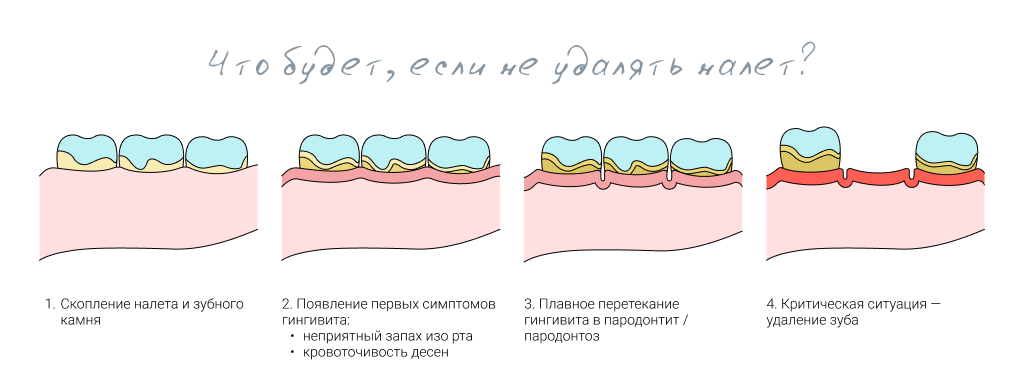 что будет если не удалять налет
