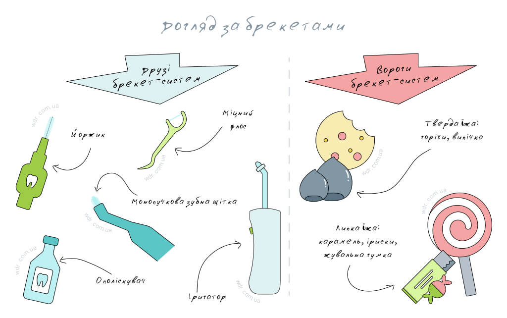 догляд за брекетами