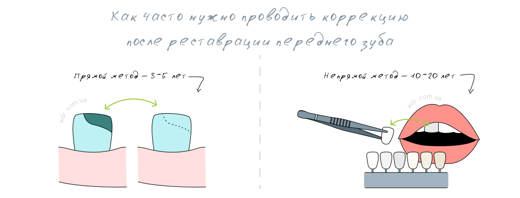 коррекция после реставрации переднего зуба