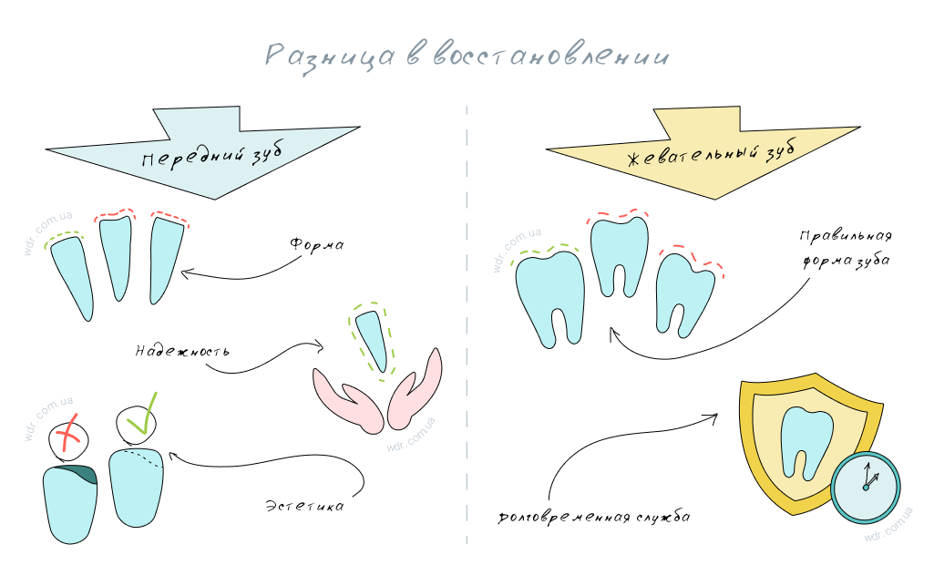 разница восстановления передних и жевательных зубов