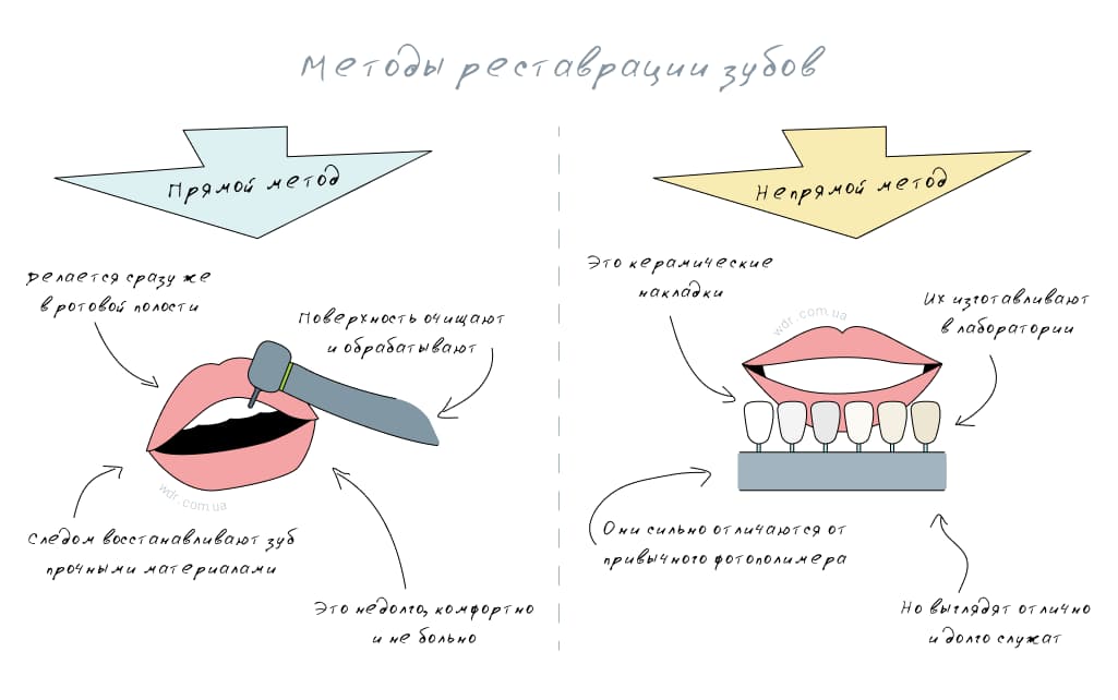 способы реставрации зуба