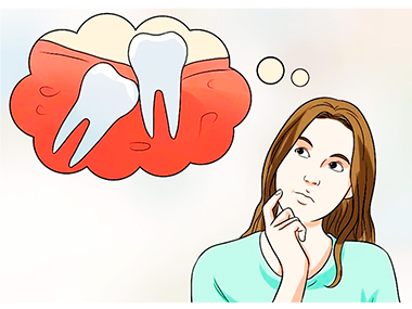 удаление зуба мудрости киев