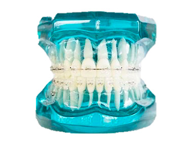 АНОМАЛИИ ПРИКУСА